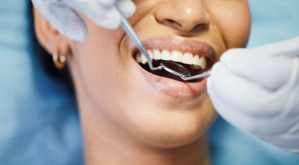 Best Emergency Denture Repair in Vevay, IN