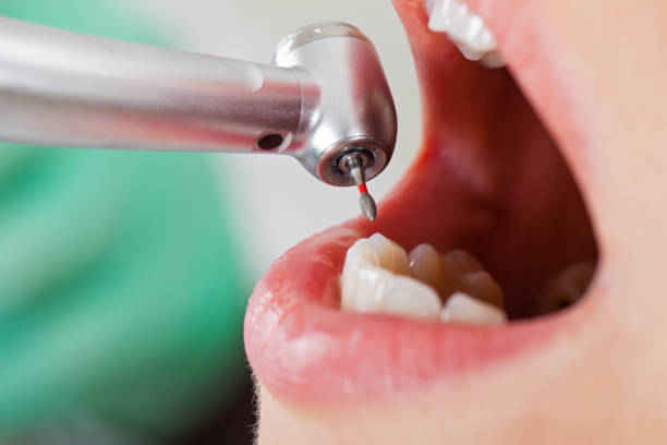 Best Emergency Treatment for Oral Infections in Vevay, IN